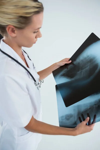 Vrouwelijke arts behandeling van x-stralen — Stockfoto