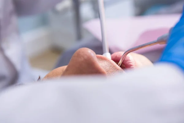 Man receiving dental treatment — Stock Photo, Image