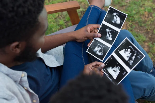 Pasangan yang melihat sonografi di taman — Stok Foto