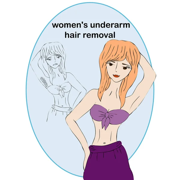 漫画美しさの女性は脱毛前に、と後。女性の脇の下の毛の取り外しの概念。不要な毛、脱毛. — ストックベクタ