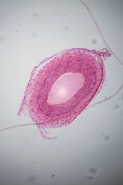 Sección venosa bajo el microscopio —  Fotos de Stock