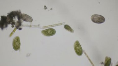 Terliksi hayvan ciliates 4 k mikroskop altında