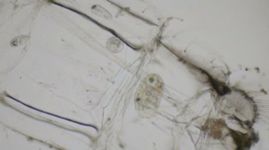 Terliksi hayvan ciliates 4 k mikroskop altında