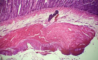 Mikroskop altında ince bağırsak parça