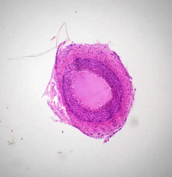 Sección de arteria bajo el microscopio —  Fotos de Stock