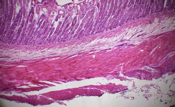 Secção do intestino delgado ao microscópio — Fotografia de Stock