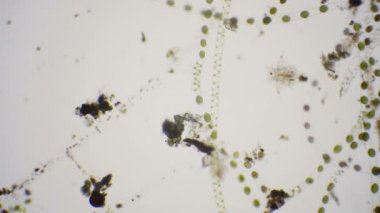 Tepegöz'ü 4 k mikroskop altında Nauplius larva