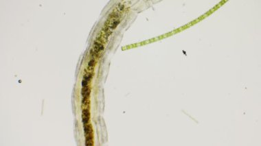 Chironomids veya biting uyarmadığın bir mikroskop ile larva