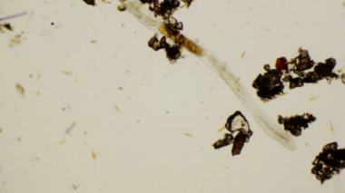 4 k mikroskop altında Yuvarlak solucanlar