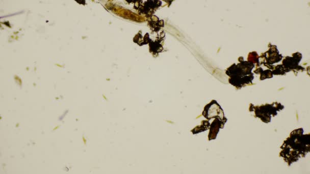 Nematodo bajo el microscopio en 4k — Vídeo de stock