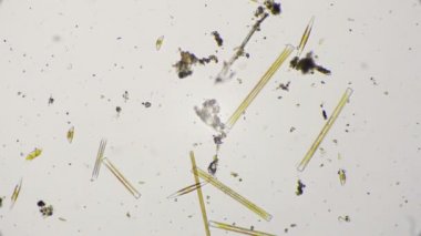 Tatlı su Diyatomlarla 4 k mikroskop altında