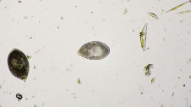 Terliksi hayvan ciliates 4 k mikroskop altında
