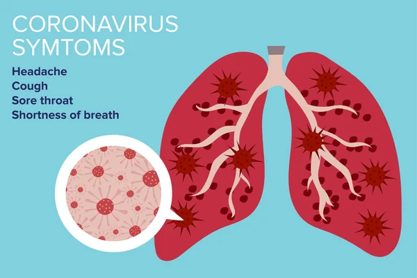 Coronavirus Concetto Sintomi Illustrazione Vettoriale — Vettoriale Stock