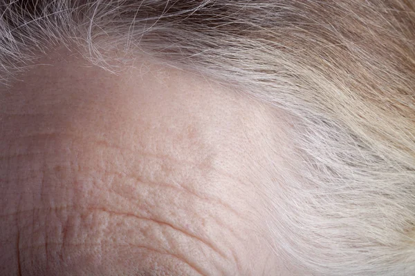 Stirn einer älteren Frau. Nahaufnahme — Stockfoto
