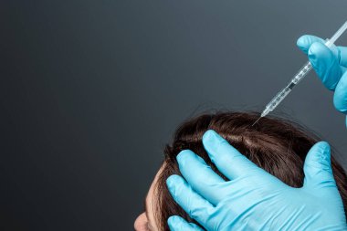 Injection for hair growth, Doctor Krupnypy Lan's hands make an injection, an injection into the head of a girl from hair loss. Health, body care, lifestyle.