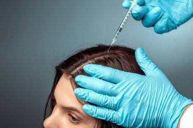 Injection for hair growth, Doctor Krupnypy Lan's hands make an injection, an injection into the head of a girl from hair loss. Health, body care, lifestyle.