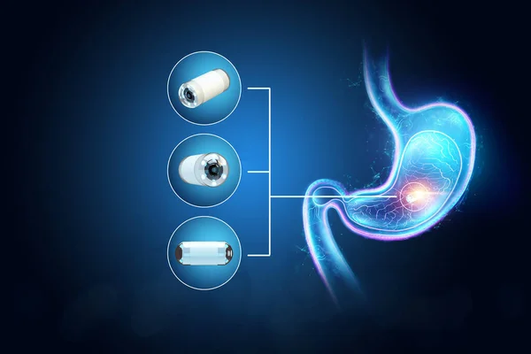 Doctor against the background of a hologram of the stomach, A camera the size of a capsule in the stomach, an endoscopy procedure. Digestive tract disease concept. 3D rendering, 3D illustration