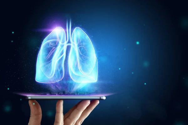 Hologramme Des Poumons Enflammés Dans Corps Humain Concept Maladie Pulmonaire — Photo