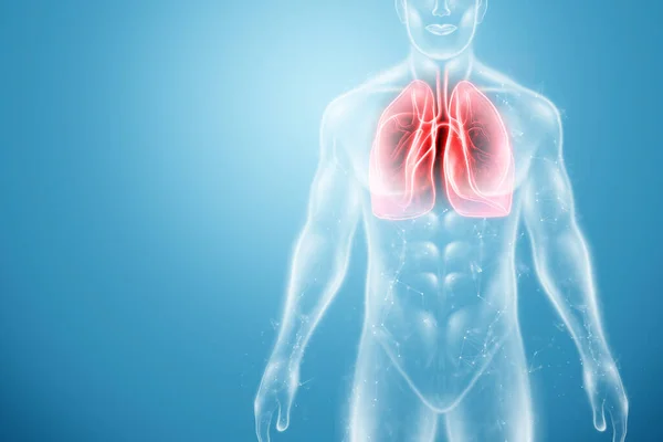 Hologramme Des Poumons Enflammés Dans Corps Humain Concept Maladie Pulmonaire — Photo