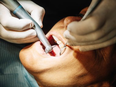 Diş hekimi hastasının ağzını açar ve hastayı yeniden gözden geçirmeye başlar. 