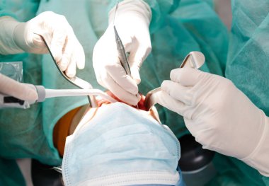 Yukarıdan gelen lateks eldivenli profesyonel dişçiler çağdaş klinikte tanınmayan hastalara oral işlem yapmak için temiz aletler kullanıyorlar.