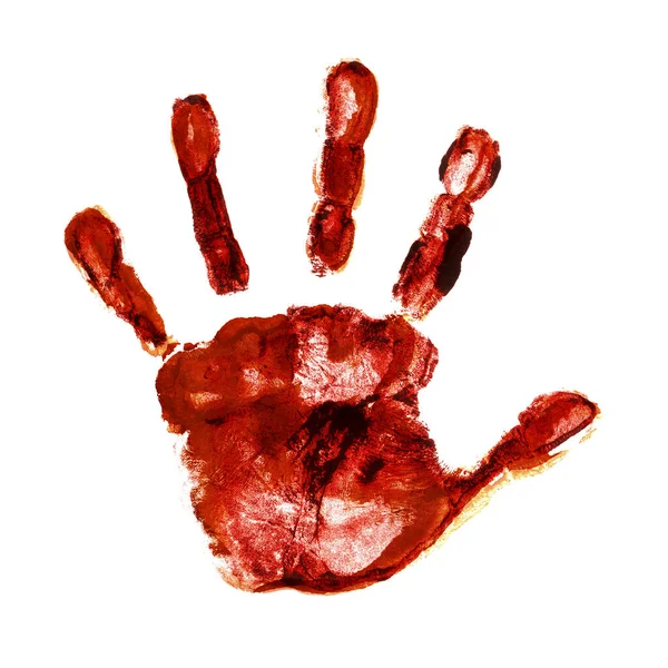 Schmutzige Infizierte Handfläche Als Krankheitsträger Isoliert Auf Weißem Hintergrund — Stockfoto