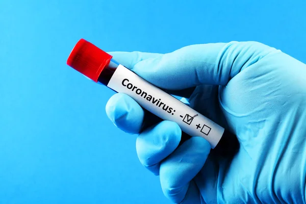 Coronavírus Mão Doutor Numa Luva Azul Amostra Sangue Vitro Para — Fotografia de Stock