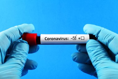 Coronavirus. Mavi eldivenli bir doktorun eli. Analiz için kan örneği tüp bebek. Mavi arkaplan.