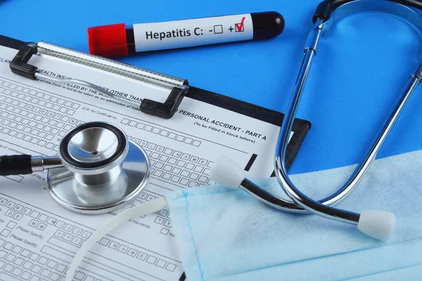 Hepatit C için kan testi. Kanlı vakum tüpü. Mavi arkaplan.