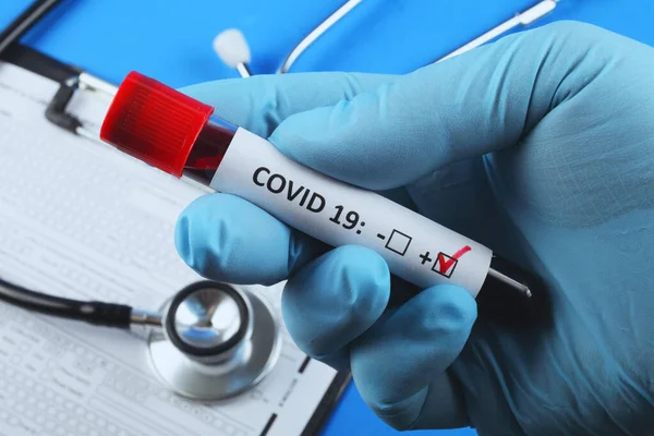 Prova Sangue Para Coronavírus Tubo Vácuo Com Sangue Fundo Azul — Fotografia de Stock