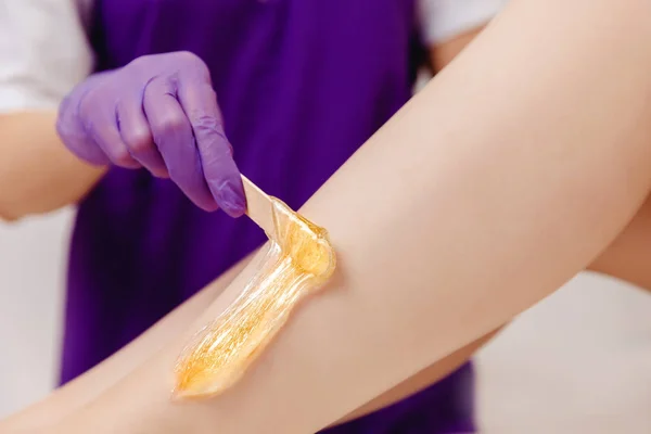 Aplicação de pasta de açúcar para shugaring depilação com raspador na pele de pernas de menina. Conceito de remoção de cabelo — Fotografia de Stock