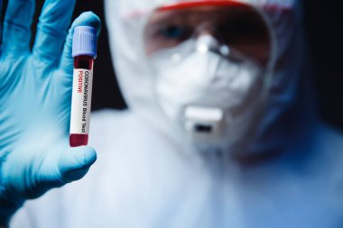 Coronavirus 2019-ncov kan örneği, beyaz tehlikeli madde koruma programında sağlık görevlisini tutuyor. Salgın virüs solunumunu kavra