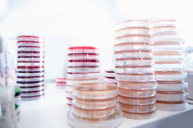 Mikrobiyoloji labaratuvarı maya tarımı Agar orta plaka, beyaz arkaplan