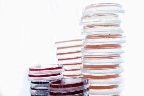 Mikrobiologi laboratorium jäst odling på agar medium platta, vit bakgrund — Stockfoto