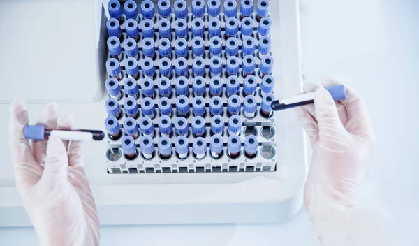 Laboratorio de tubos de análisis de sangre para análisis con epidemia de virus — Foto de Stock