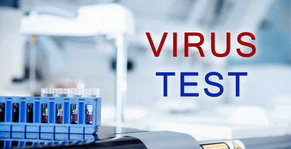 El laboratorio bioquímico realiza pruebas de sangre humana y animal para el virus 2019-ncov. Concepto pandémico de Europa y del mundo — Foto de Stock