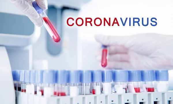 Banner coronavirus 2019-ncov microbiologist blood test, blurred background