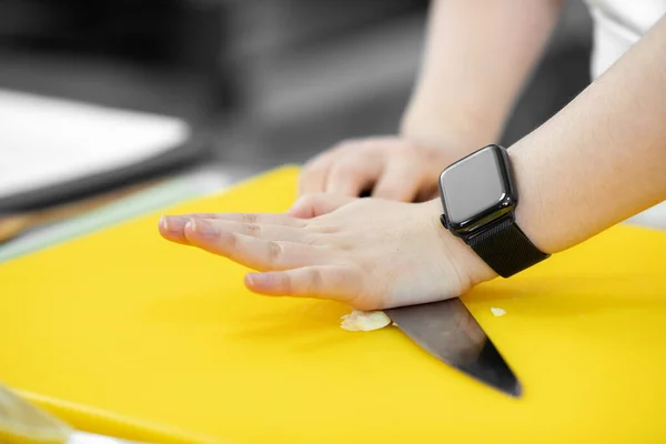 Mani donna chef taglio coltello con aglio e cipolla sul tagliere primo piano — Foto Stock