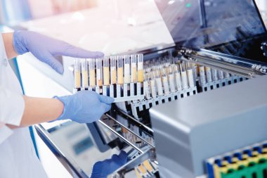 Otomatik robot laboratuvarı tıbbi ekipmanlarıyla çalışan kan testi uzmanı.