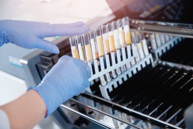 Biyomühendis DNA analizi ve insan klonlaması için kan örnekleri indiriyor.