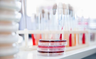 Mikrobiyoloji labaratuvarı maya tarımı Agar orta plaka, beyaz arkaplan