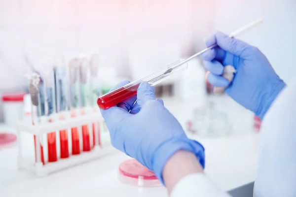 Enfermeira microbiologista segurando tubo de teste com sangue para coronavírus 2019-nCoV analisando — Fotografia de Stock