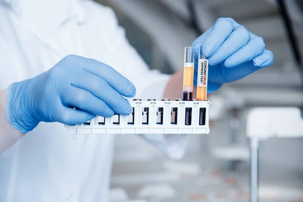 Bioengineer tiene tubos de ensayo de muestras de sangre para el análisis de ADN y presencia de virus en el citoplasma, fondo borroso — Foto de Stock