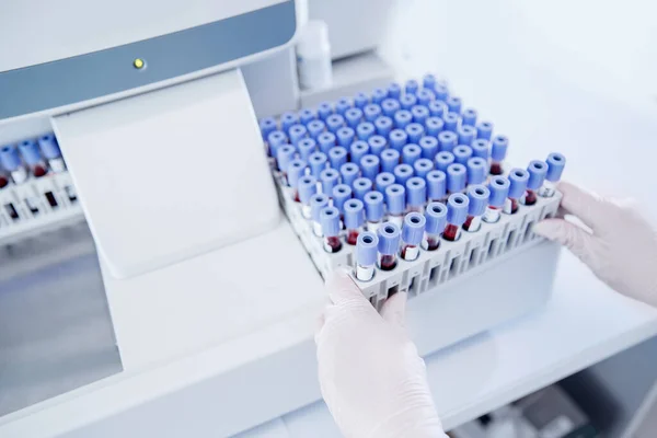 Laboratorio de tubos de análisis de sangre para análisis con epidemia de virus — Foto de Stock