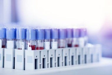 Virüs salgını analizi için kan testi tüpü laboratuvarı