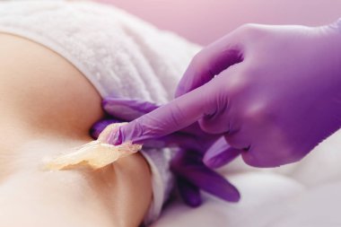 Kolunun altındaki deri dökülmesine sıvı şeker yapıştırıcısı sürüyorum. Şekerli güzellik konsepti