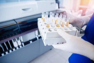 Hemşire mikrobiyolog, Coronavirus 2019 nCoV analizi için kanla test tüpü tutuyor.
