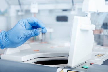 Tıbbi laboratuvarda insan tükürüğü analizi.