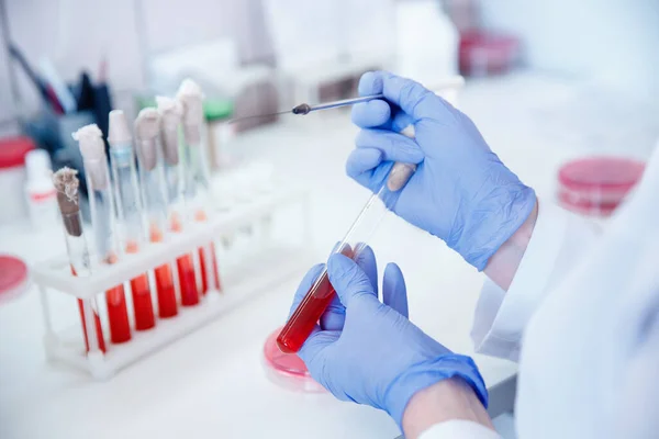 Női orvos dolgozik vérmintával laboratóriumi, kék színű — Stock Fotó