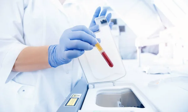 Trabalhador médico em laboratório coloca amostra de sangue para exame em analisador automático. Teste de ADN, detecção de vírus. Fundo de luz azul — Fotografia de Stock